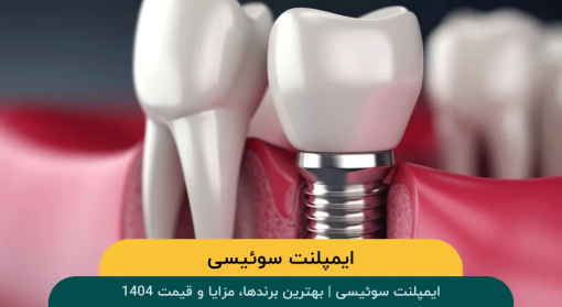 ایمپلنت-سوئیسی